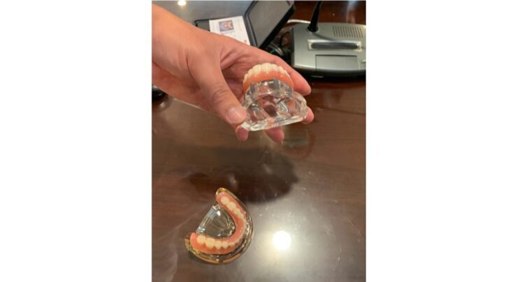 台南成醫數位植牙恢復完整口腔功能