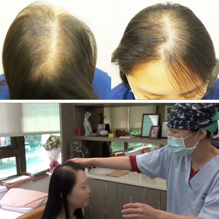 女性落髮Q&A 輕植髮女子專科門診 幫幫妳 女性落髮Q&A 輕植髮女子專科門診 幫幫妳