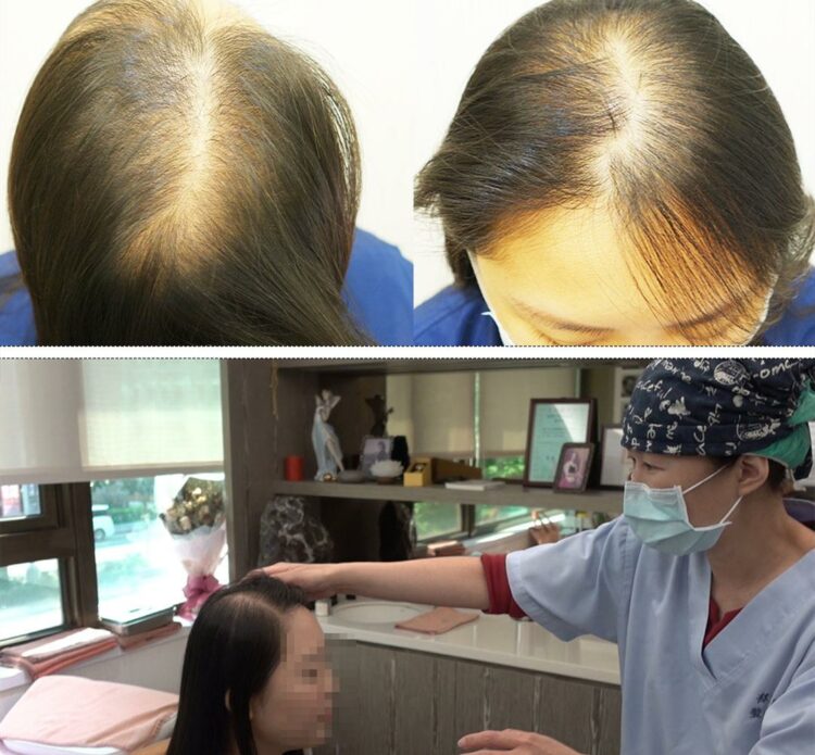  滿足女性對毛髮健康的需求   輕植髮女子專科門診成立 