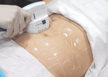 醫美新法寶 韓妞都瘋戰斧探頭懶人甩肉