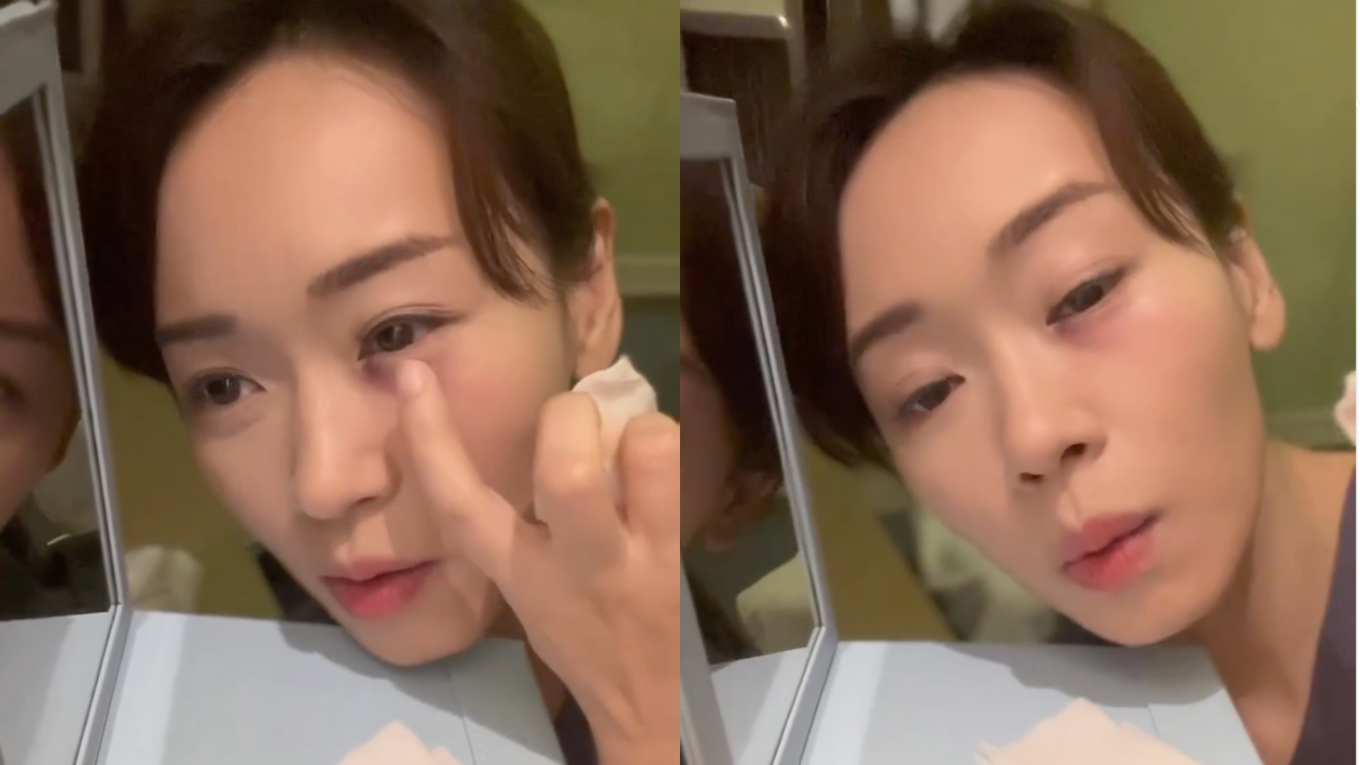 拍擄人戲太激烈！女星遭道具「直捅眼窩」　痛到流淚：差點看不到了