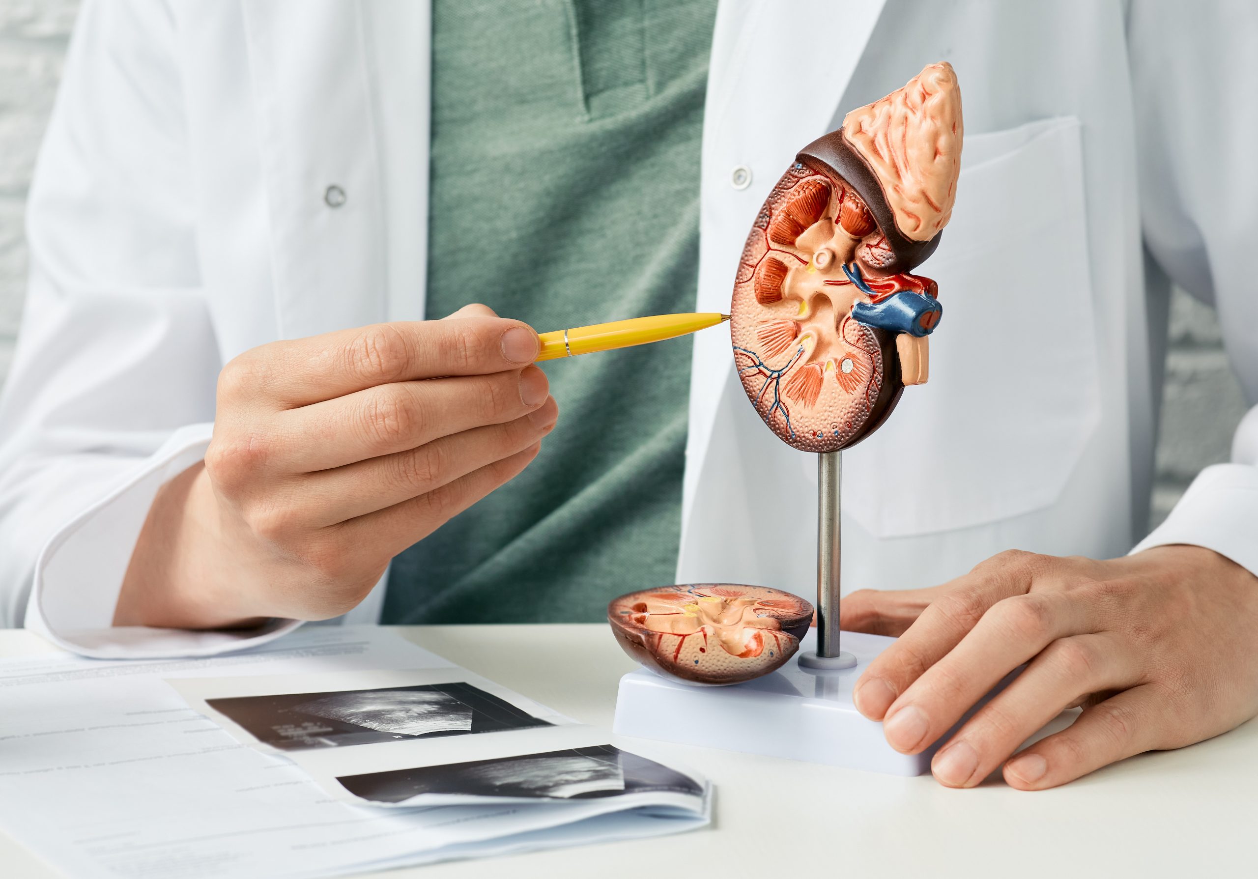 慢性腎病有望擺脫洗腎宿命！台大動科系陳明汝教授成功開發「Lm益生菌」可延緩腎功能惡化 榮獲國家新創獎肯定