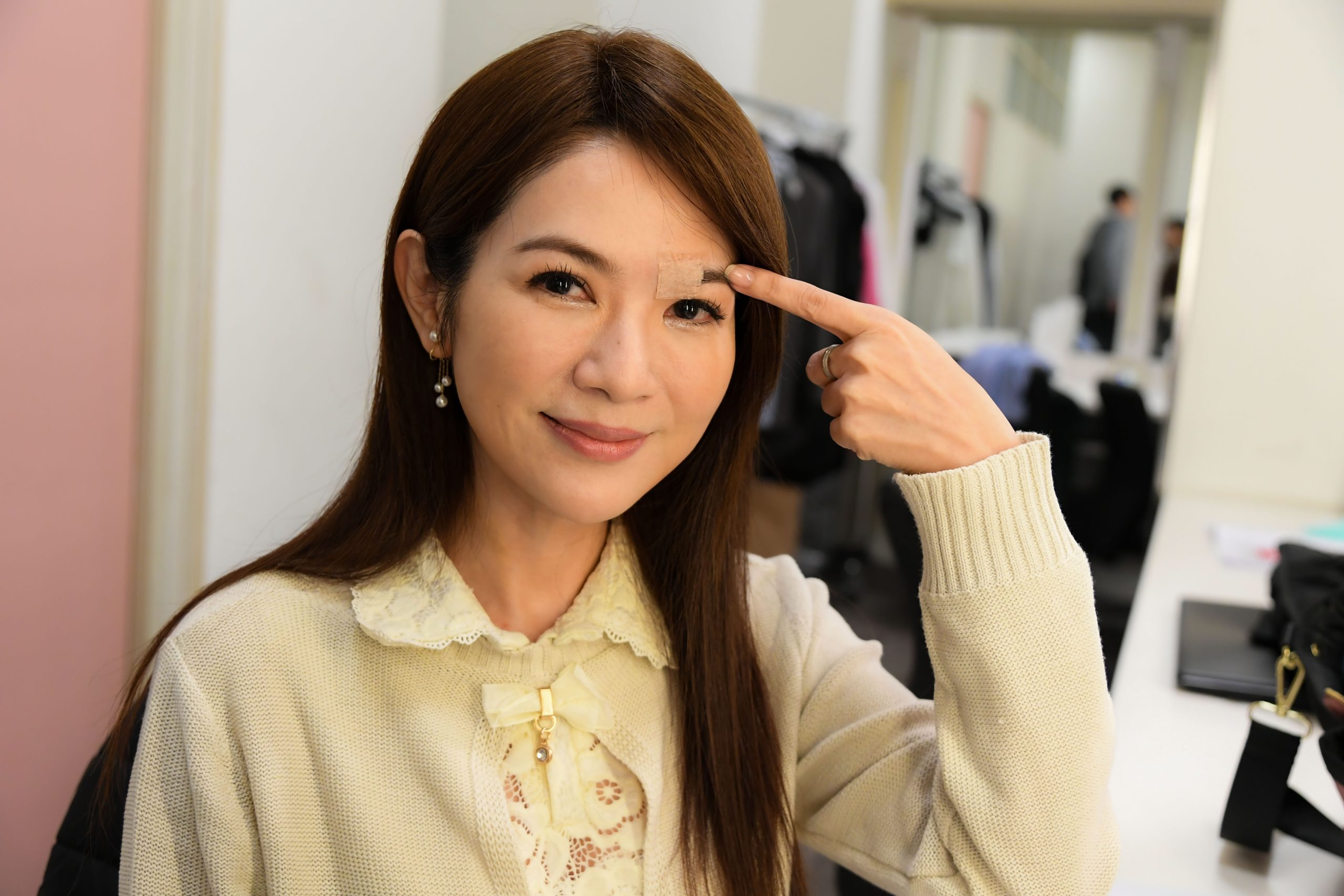 慎入！女星摔傷破相縫十多針　編劇忙改劇本