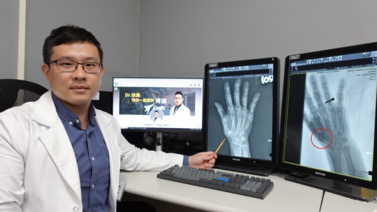 拇指基底關節炎僵硬劇痛,微創血管治療疼痛指數7分降為1分 拇指基底關節炎僵硬劇痛,微創血管治療疼痛指數7分降為1分