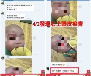 高雄五月男嬰疑被虐-社會局強調訪視時沒有異常