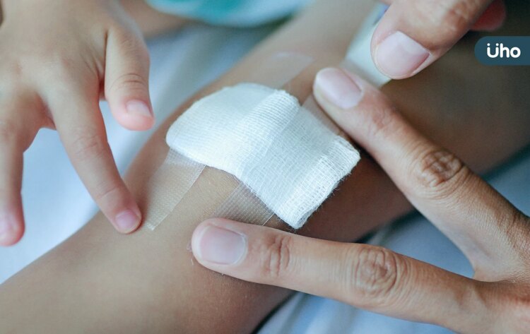 手術傷口不能碰水?日本絆創膠過時了!醫建議用「它」黏合皮膚不留疤 手術傷口不能碰水?日本絆創膠過時了!醫建議用「它」黏合皮膚不留疤