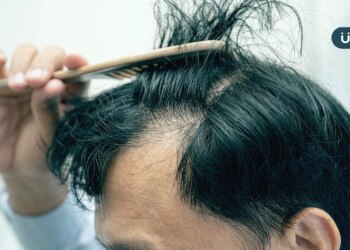 女性交友第一印象先看「有沒有禿頭」！調查揭「ng行為」恐加劇落髮