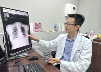 肋骨骨折治療方式新選擇-鈦合金鎖定式鋼板輔以3d模擬列印技術