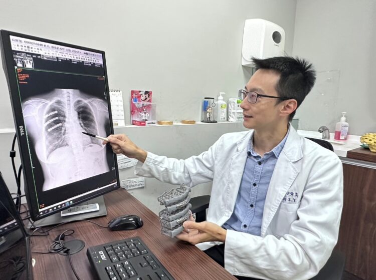 肋骨骨折治療方式新選擇-鈦合金鎖定式鋼板輔以3d模擬列印技術