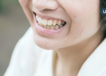 牙齒鬆動不是自然老化！醫曝「牙周病典型症狀」這招幫助牙周再生