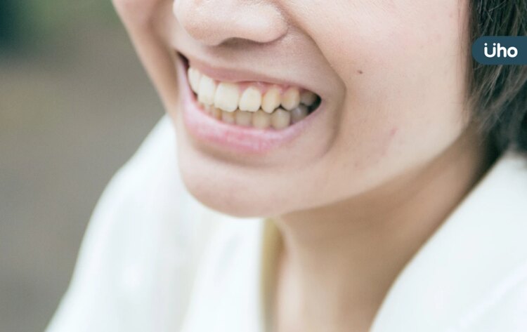 牙齒鬆動不是自然老化!醫曝「牙周病典型症狀」這招幫助牙周再生 牙齒鬆動不是自然老化!醫曝「牙周病典型症狀」這招幫助牙周再生