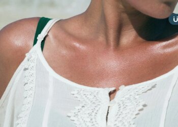 夏天曬傷怎麼辦？皮膚發紅脫皮、長水泡⋯皮膚科醫：就醫前快做1事