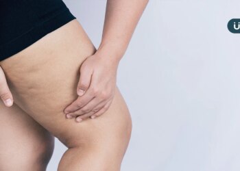 大腿、肚子長橘皮好難看⋯如何消除？不只靠減肥，教你「3招」預防