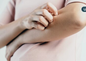 冬季皮膚乾癢受不了？醫提醒「2類人」不用天天洗澡：每週●●次就夠