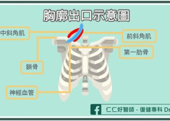 為什麼會手麻無力？復健醫揪「胸廓出口症候群」3分鐘抬手就能測試