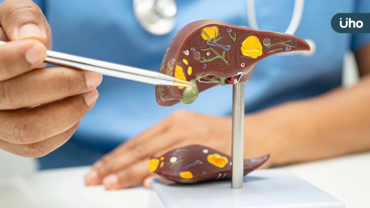 B、C型肝炎併發代謝異常死亡風險及罹癌機率高 臺大醫院治療預防新研究 榮登頂尖國際期刊 b、c型肝炎併發代謝異常死亡風險及罹癌機率高-臺大醫院治療預防新研究-榮登頂尖國際期刊