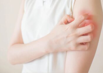 好不了的濕疹？乾癬？小心是罕見皮膚T細胞淋巴瘤