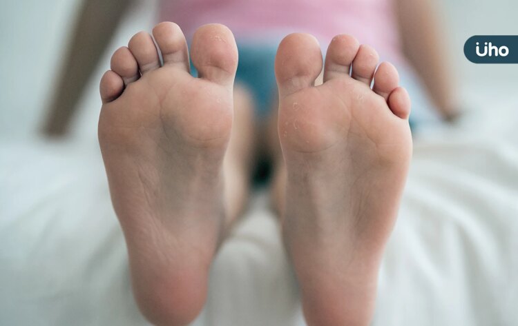 雙腳癢到睡不著，小心不寧腿症候群！醫揭「6大非藥物策略」改善症狀