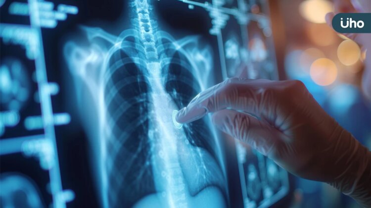 盼健保予存活希望!無腫瘤基因突變肺腺癌病患喊話:給付免疫藥物合併標準化療 盼健保予存活希望!無腫瘤基因突變肺腺癌病患喊話:給付免疫藥物合併標準化療