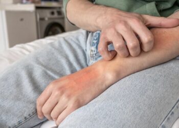 中醫調理乾癬 內外兼治 溫和改善皮膚困擾 擺脫紅疹瘙癢 重拾健康自信