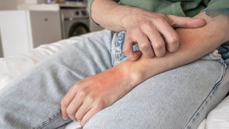 中醫調理乾癬 內外兼治 溫和改善皮膚困擾 擺脫紅疹瘙癢 重拾健康自信 中醫調理乾癬 內外兼治 溫和改善皮膚困擾 擺脫紅疹瘙癢 重拾健康自信