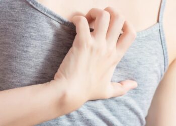 乾癬竟致親密關係受損？醫：及早治療助解決