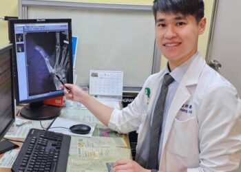 拇指腕掌關節炎常合併媽媽手、板機指-疼痛難纏！-「關節鏡清創及復位手術」讓她重回職場