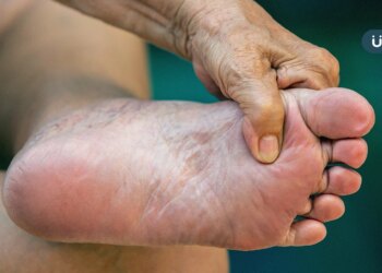 為什麼會糖尿病足潰瘍？醫示警「4大狀況」要小心：亂剪指甲也上榜