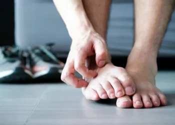 哪些人容易得香港腳？皮膚科醫列「5大黴菌感染源」這種腳型易感染