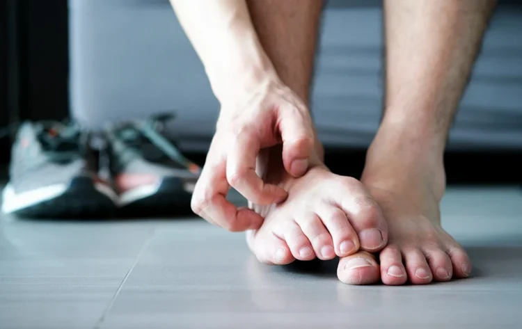 哪些人容易得香港腳？皮膚科醫列「5大黴菌感染源」這種腳型易感染