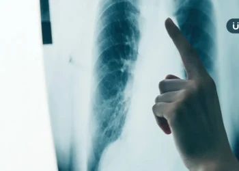 年省150萬藥費！石崇良：健保擴大給付「晚期肺癌」2000人受惠