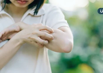 超慢跑也可治皮膚問題？中醫教「4招日常調理」改善反覆紅疹、皮膚癢