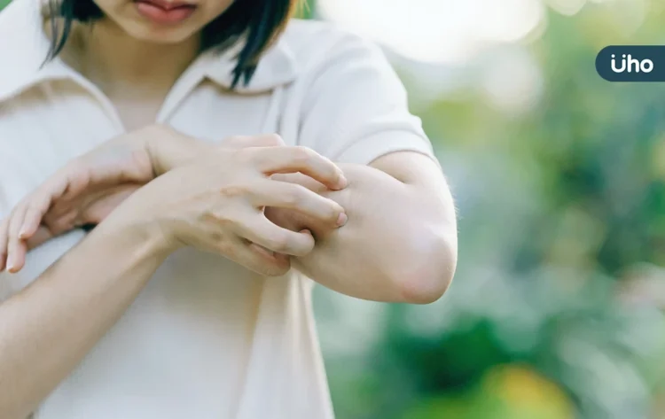 超慢跑也可治皮膚問題?中醫教「4招日常調理」改善反覆紅疹、皮膚癢 超慢跑也可治皮膚問題?中醫教「4招日常調理」改善反覆紅疹、皮膚癢