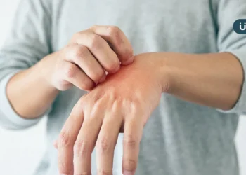 老翁夜間搔癢竟抓出「千蟲鑽動」！醫警告「結痂型疥瘡」恐感染全家