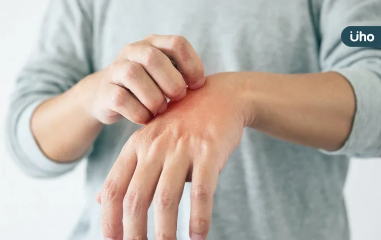 老翁夜間搔癢竟抓出「千蟲鑽動」!醫警告「結痂型疥瘡」恐感染全家 老翁夜間搔癢竟抓出「千蟲鑽動」!醫警告「結痂型疥瘡」恐感染全家