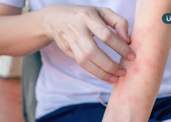 乾燥、皮疹⋯全身癢又痛！台大醫揭「異位性皮膚炎」恐是免疫失調