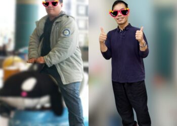 夫妻同心攜手甩肉50公斤！ 小港醫院透過「內視鏡袖狀胃成形術」助夫妻檔找回健康與自信