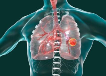 肺癌標靶治療新思維：療效與生活品質如何兼得？