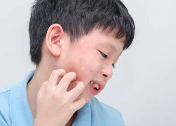 健保放寬口服小分子標靶藥給付至兩年 異位性皮膚炎迎來新曙光