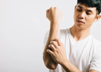 卸下長袖 告別脫皮人生 醫:穩控乾癬避免引發關節炎 卸下長袖 告別脫皮人生 醫:穩控乾癬避免引發關節炎