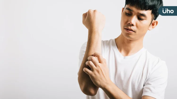 卸下長袖 告別脫皮人生 醫：穩控乾癬避免引發關節炎