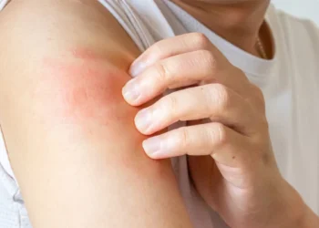 異膚治療不中斷!健保新藥想要「再上車」 病友該怎麼做? 異膚治療不中斷!健保新藥想要「再上車」 病友該怎麼做?