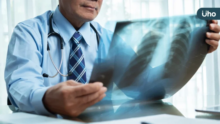 50歲男肺癌連葉克膜都用上!免疫治療+抗血管新生合併化療穩病情 50歲男肺癌連葉克膜都用上!免疫治療+抗血管新生合併化療穩病情