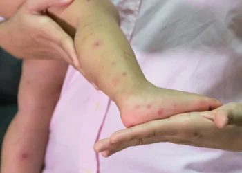 OPEN現身萬芳醫院陪童過節 洗手操防腸病毒寓教於樂